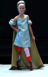 Catwalk with prosthetic limbs Daisy-May Demetre (9) from Birmingham was born with fibular hemimelia, where part or all of the bone in her lower leg is missing. Her legs were amputated when she was just 18 months old, after which she learnt to walk with prosthetic legs. Daisy caught the attention of the fashion world as she walked the ramp at the Eiffel Tower in Paris for a luxury French children’s brand. This was her third catwalk, after two other fashion shows at New York and London. 