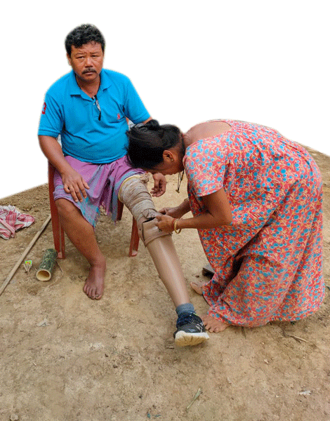Forest guard Sat Singh Tamong with his prosthetic leg.