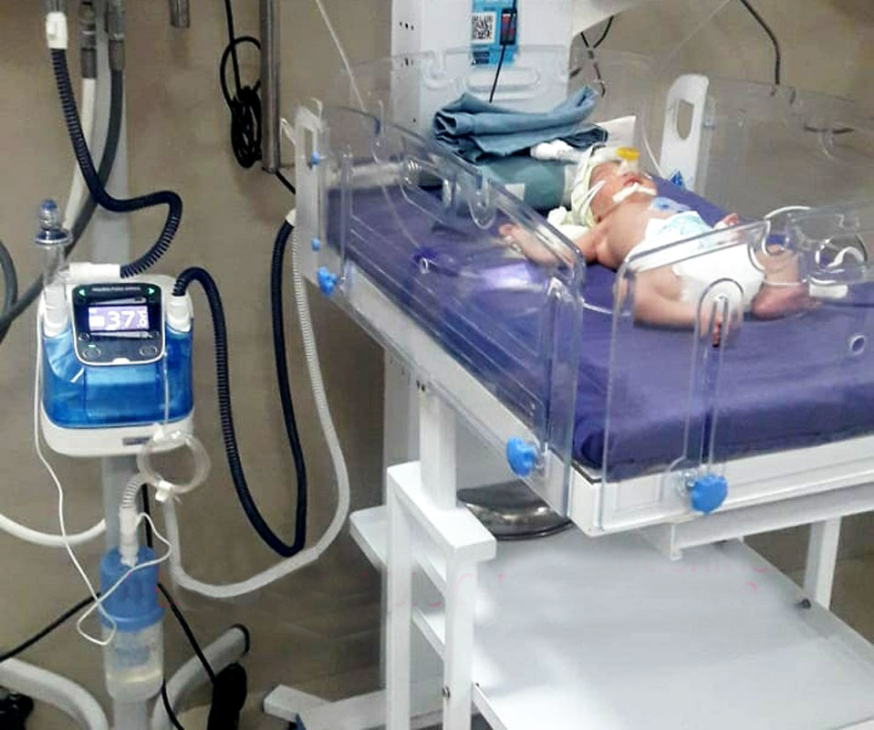 An infant being treated on a bubble CPAP machine.